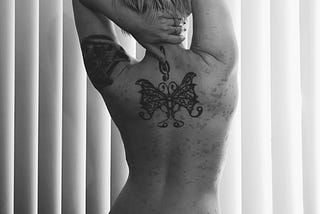 A photo of the author’s bare back. She has 2 large tattoos on her upper back and upper left arm, and hives on her skin.