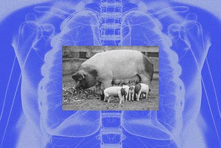 Hooking Up Human Lungs to Pigs Could Save Them for Transplant