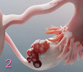 Image shows an overall pink sketch of an ovary and fallopian tube. On the left of the image is the round shape of the uterus.