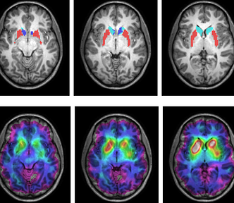 6 brain images