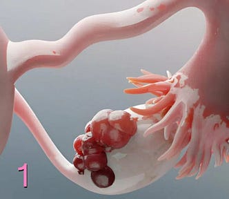 Image shows an overall pink sketch of an ovary and fallopian tube. On the left of the image, is the round shape of the uterus.