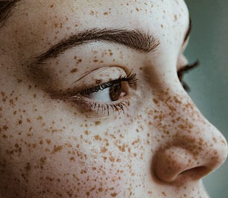 Closeup of woman’s face with freckles.