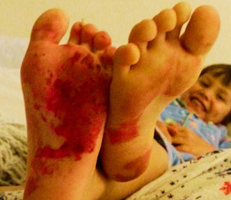Young child giggling showing the soles of his feet covered in red nail polish.