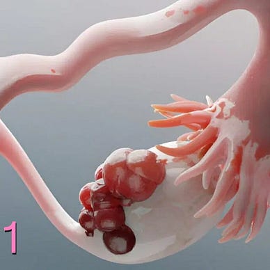 Image shows an overall pink sketch of an ovary and fallopian tube. On the left of the image, is the round shape of the uterus.