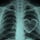 Heart Surgery, Medicine, Health