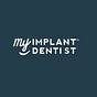 All-on-4 Dental Implants Perth