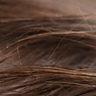 Hair Loss, Explained
