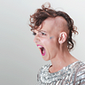 Lady Alopecia