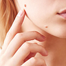 Radiant Cutis Skin Tag Remover