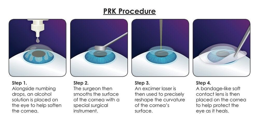 PRK recovery notes