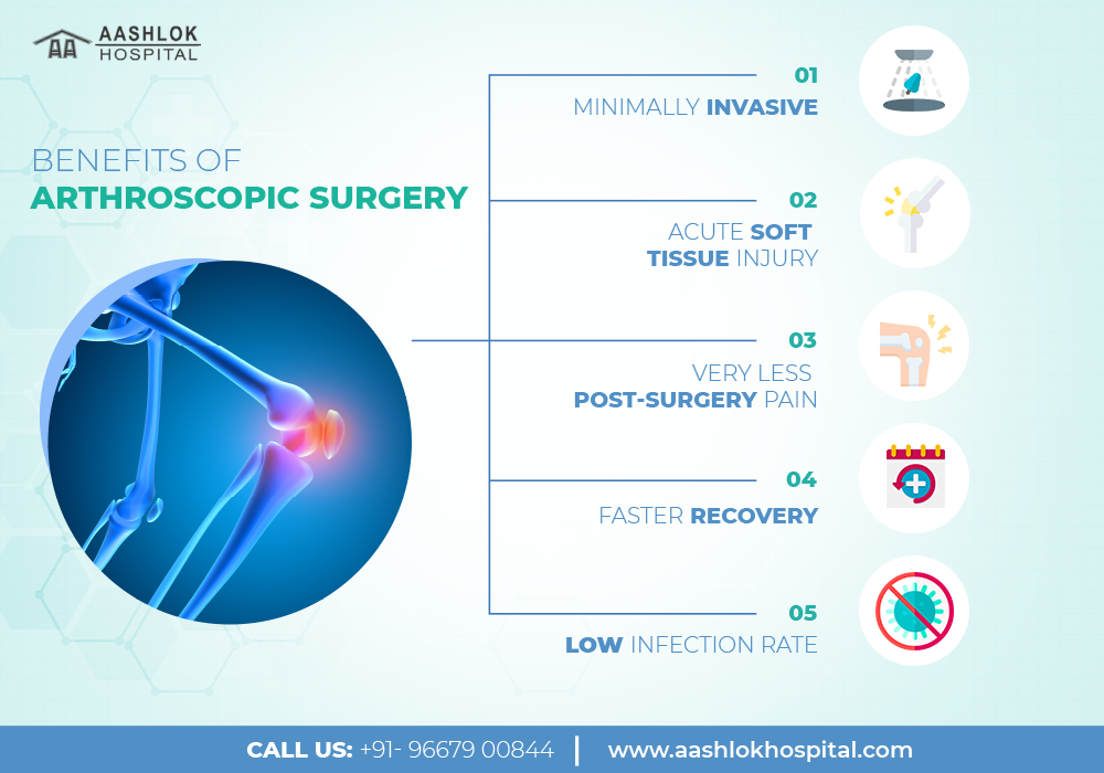 Arthroscopic Surgery Purpose, Procedure, Benefits, Cost & Recovery