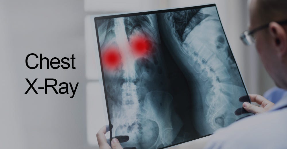 What is chest X-ray? How to shoot?