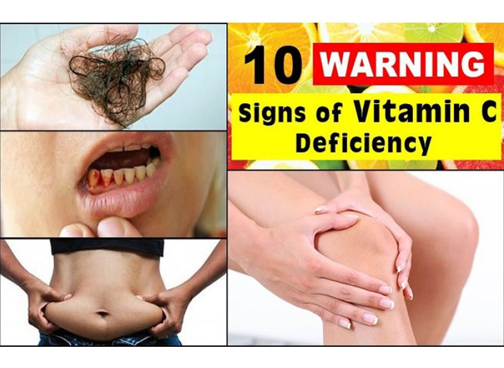 The Warning Signs Of Vitamin C Deficiency And How To Treat It By Your 