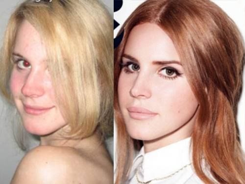 LANA DEL REY PLASTIC INSIGHT. Lana Del Ray is an American singer… | by VIEW PLASTIC  SURGERY | Medium