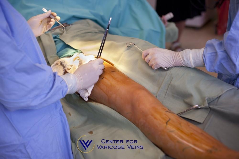 How Has Varicose Vein Treatment Changed Over the Years?