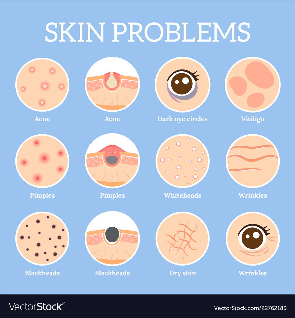 why is my skin so itchy.. 1 Itchy skin, also known as pruritus… by