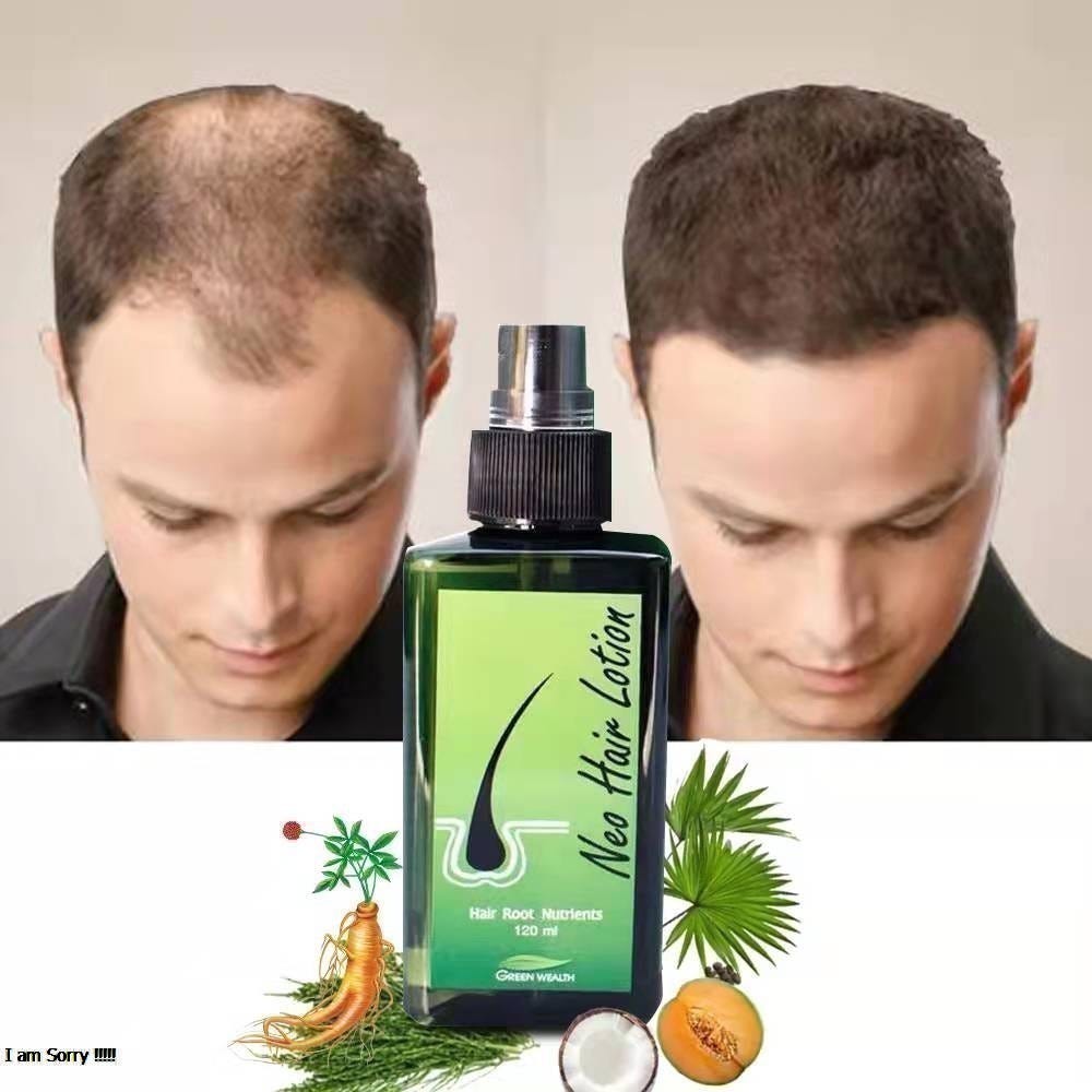 Neo Hair Lotion Price In Pakistan — How to Use Neo hair lotion