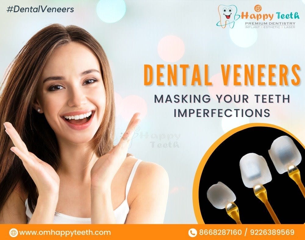 Dental Veneers Masking Your Teeth Imperfections — The Ultimate Guide