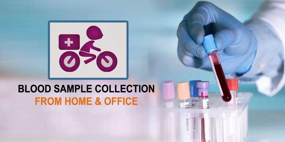 Lab Tests at Your Doorstep The Emergence of Home Blood Sample