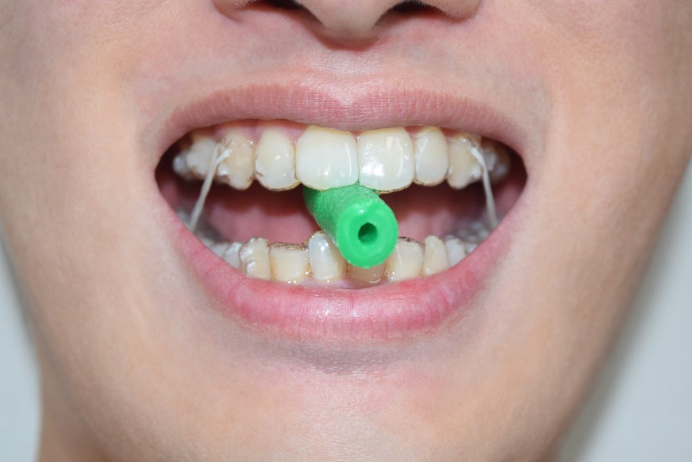 What Are Invisalign Chewies And How Can They Help? by WillowBrook
