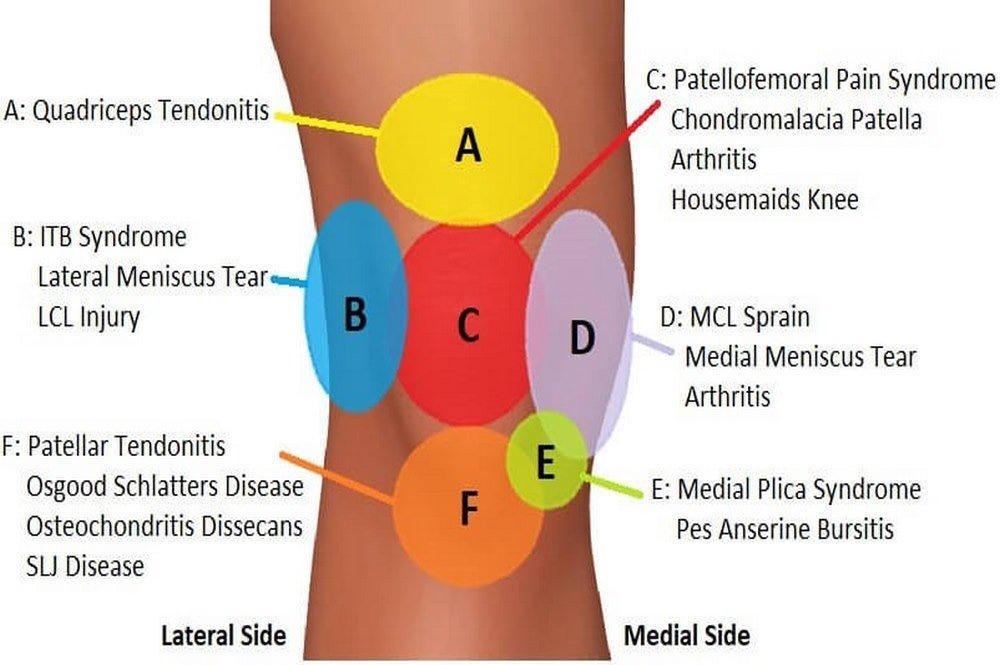 A Comprehensive Guide About Knee Pain Location Chart | By ...