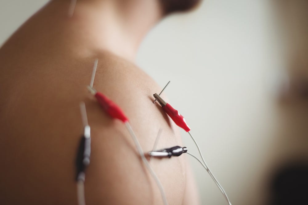 Benefits of Electrotherapy in Physical Therapy 