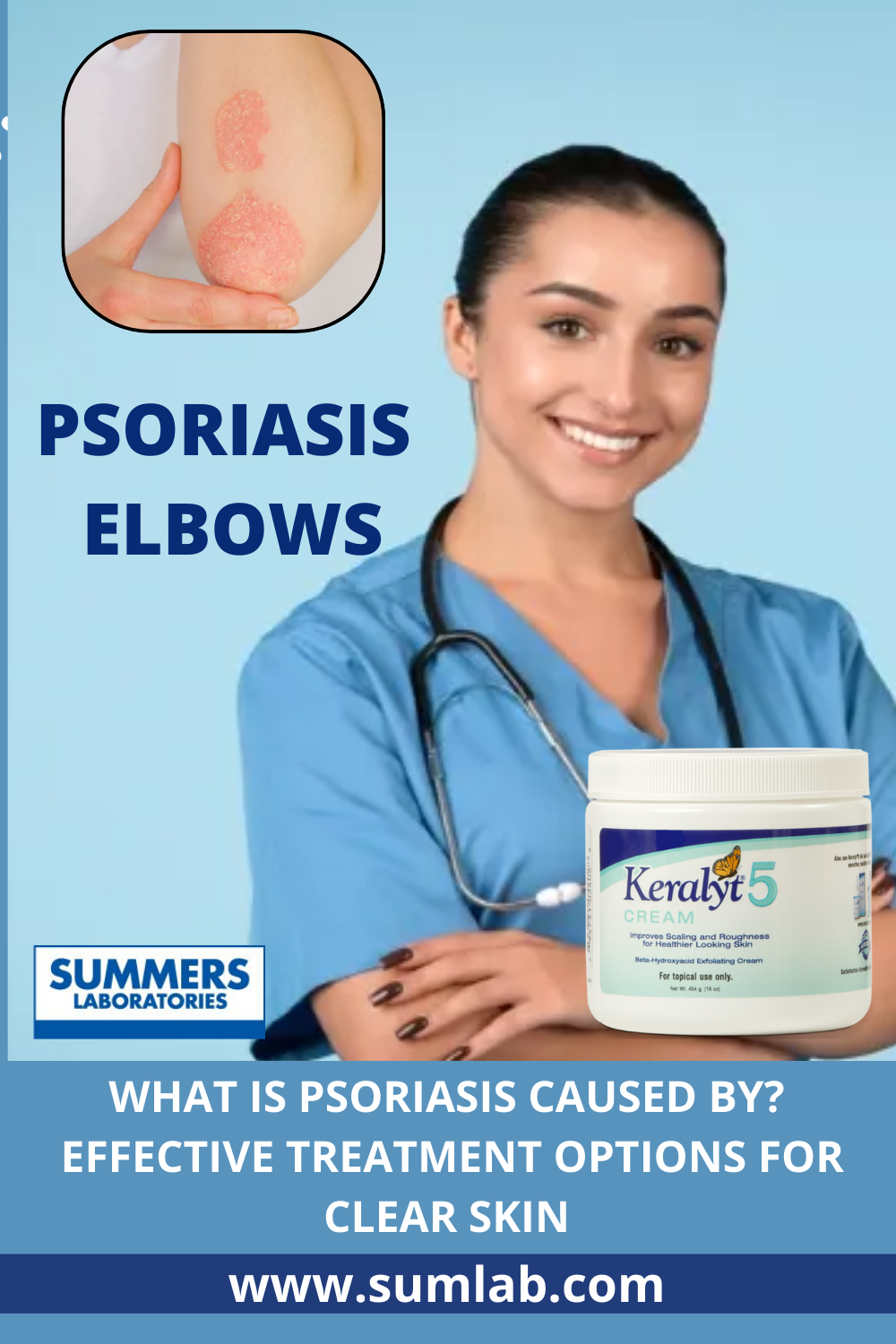 What is Psoriasis? How do I get rid of psoriasis on my elbow