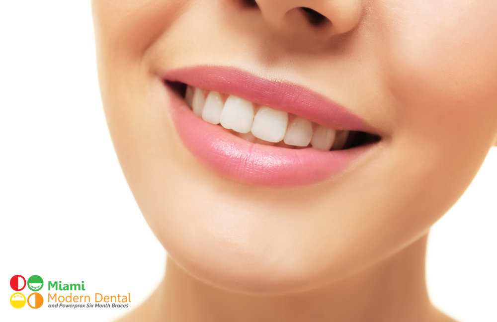 What Not To Do After Getting Your Teeth Whitened by Miami Modern