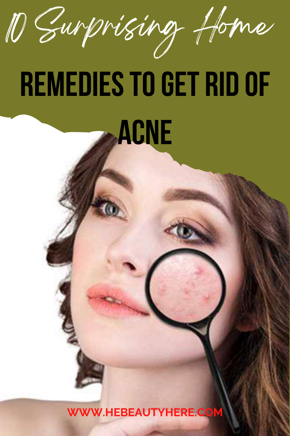 10 Surprising Home Remedies To Get Rid of Acne | by laura Elisa | Medium