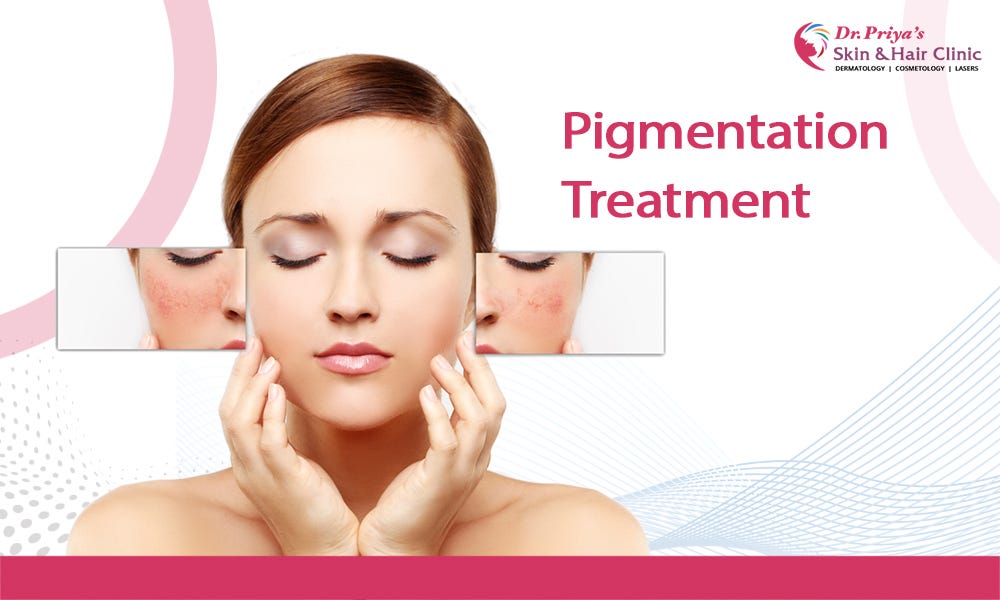 Why Should One Go For The Pigmentation Treatment In Bangalore By Dr Why Should One Go For The Pigmentation Treatment In Bangalore By Dr