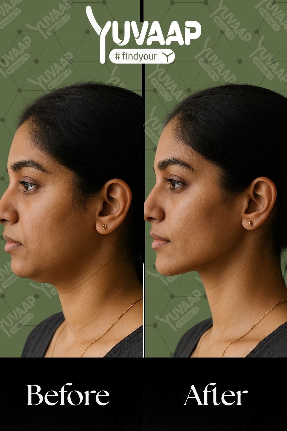 Does Mewing Really Work? Complete Guide to Jawline Posture