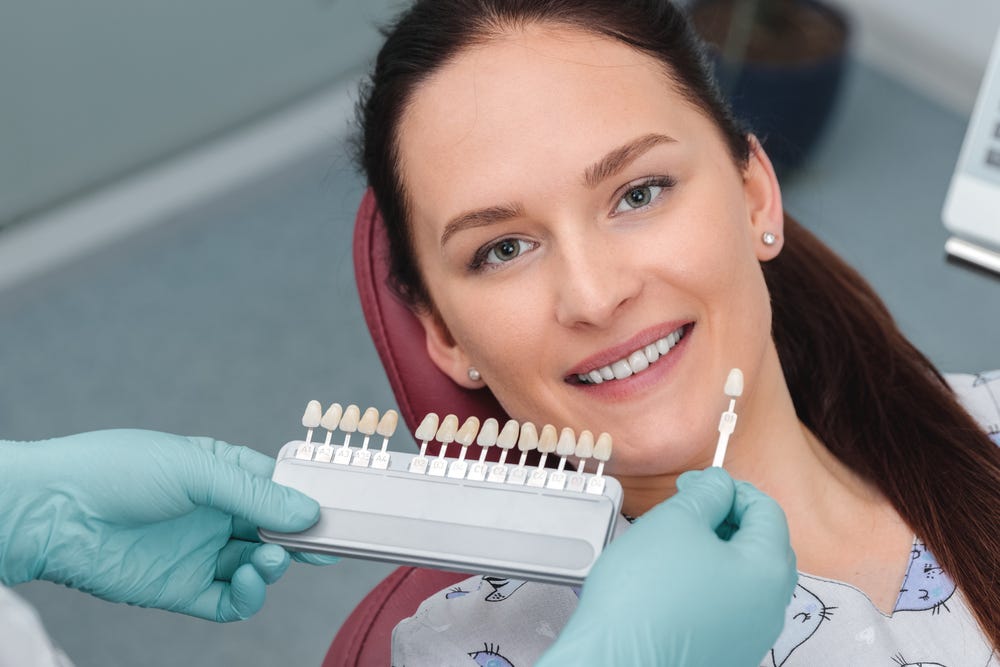5 StepbyStep What to Expect During the Dental Veneers Process by