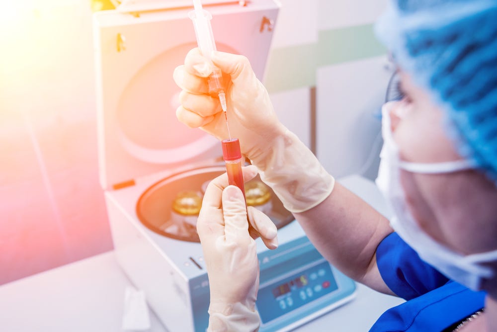 Unveiling the Benefits of PRP Therapy From hair transplant to face