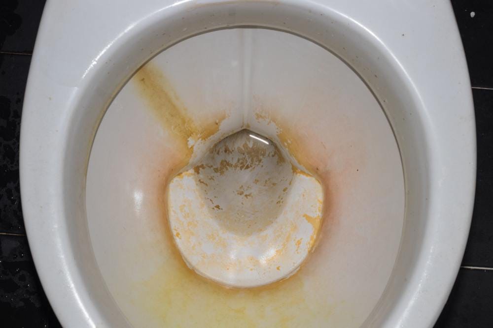 How to Clean Toilet Stains