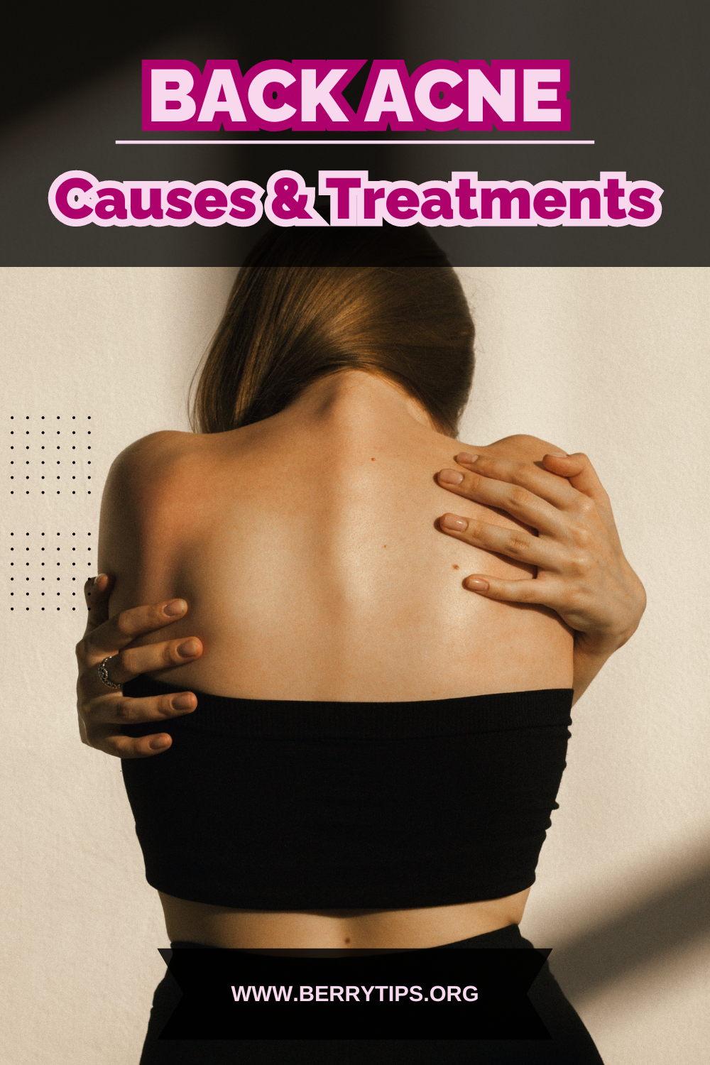 Causes Of Back Acne In Females And Treatments by Dec