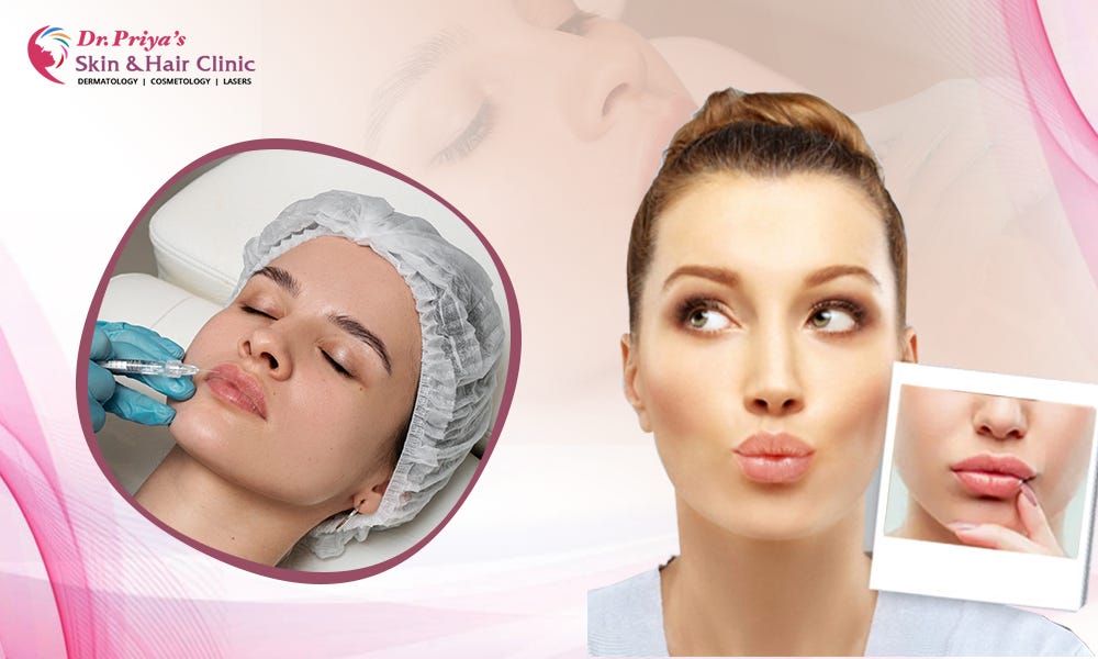Lip Augmentation in Bangalore: Transform Your Smile Without Surgery