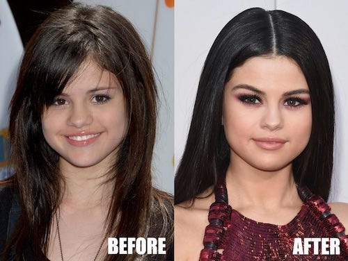 Demi lovato plastic surgery deals
