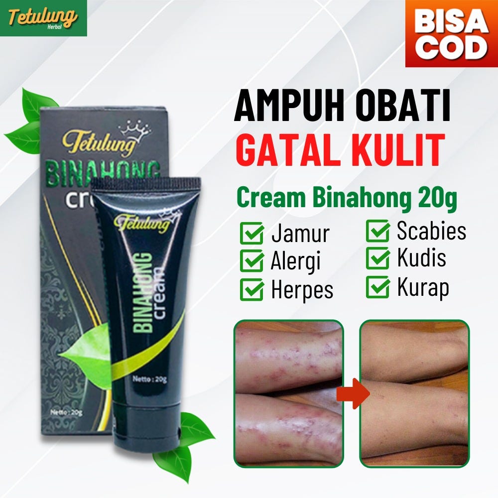 Jual Salep Obat Jamur Kulit Gatal Alergi Menahun — Binahong Cream 20g Original BPOM Tangerang