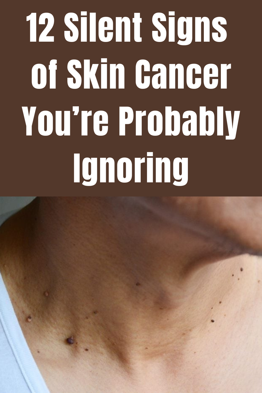 12 Silent Signs Of Skin Cancer Youre Probably Ignoring Paula Medium
