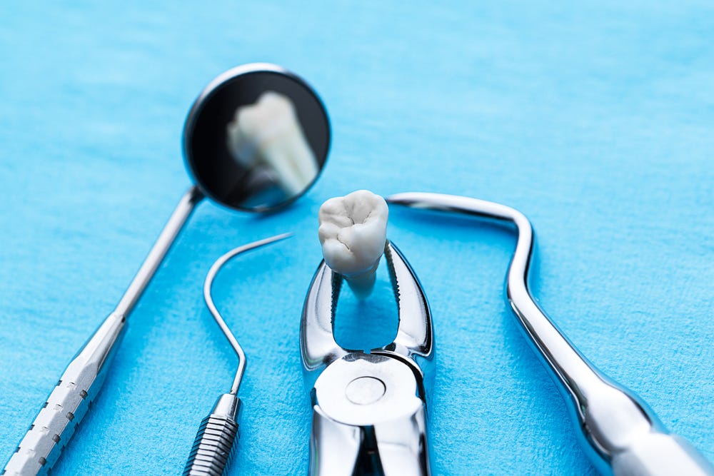 Two Types of Tooth Extractions Simple and Surgical Procedures by