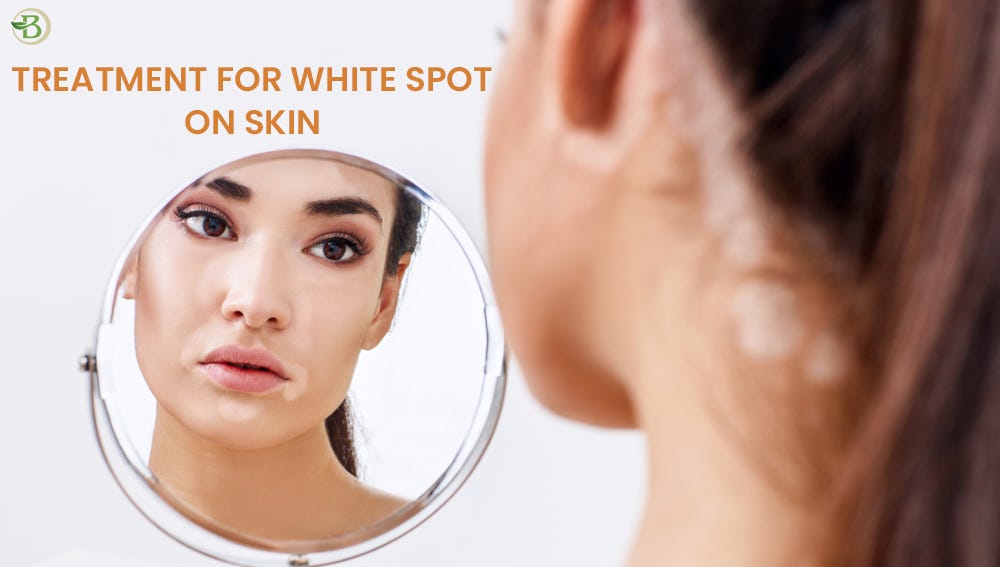 Treatments for Skin White Spots That Work Techniques for Pigment Restoration by Bharat