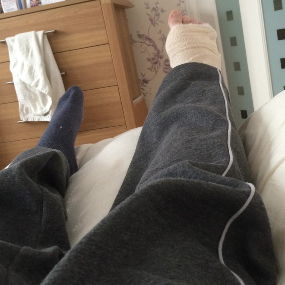 My fractured year: A broken ankle diary | by Darryl Chamberlain | Medium