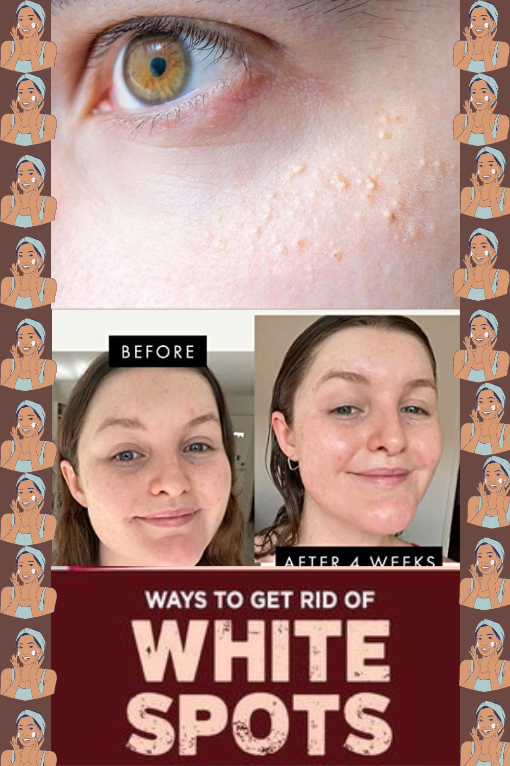 How To Get Rid Of White Spots On Face Danialkareemghori Medium
