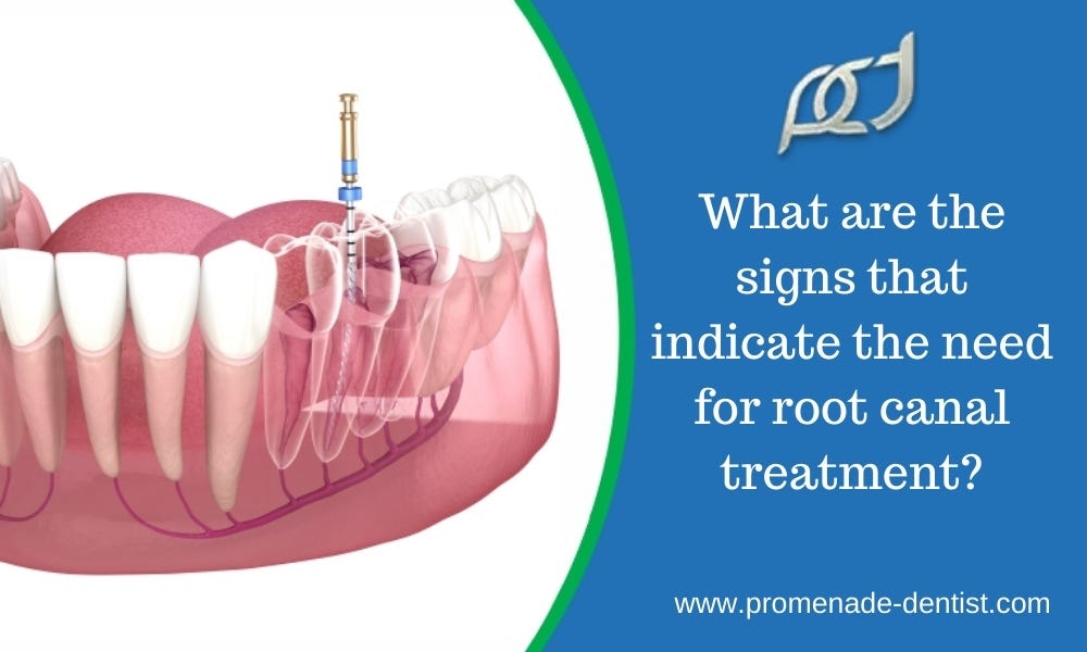 What are the signs that indicate the need for root canal treatment