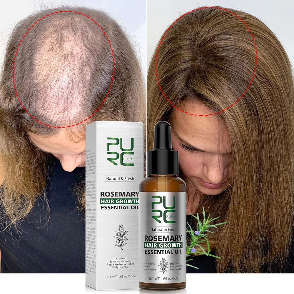 PURC Rosemary Oil Hair Growth for Men Women Fast Growing Products