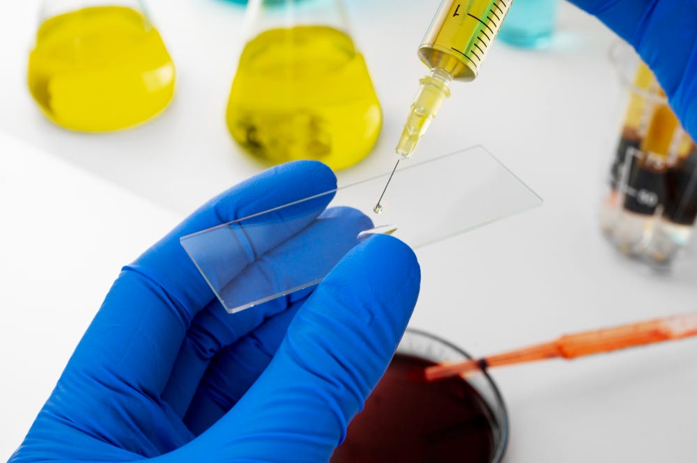 Specimen Validity Testing Ensuring the Authenticity of Urine Drug