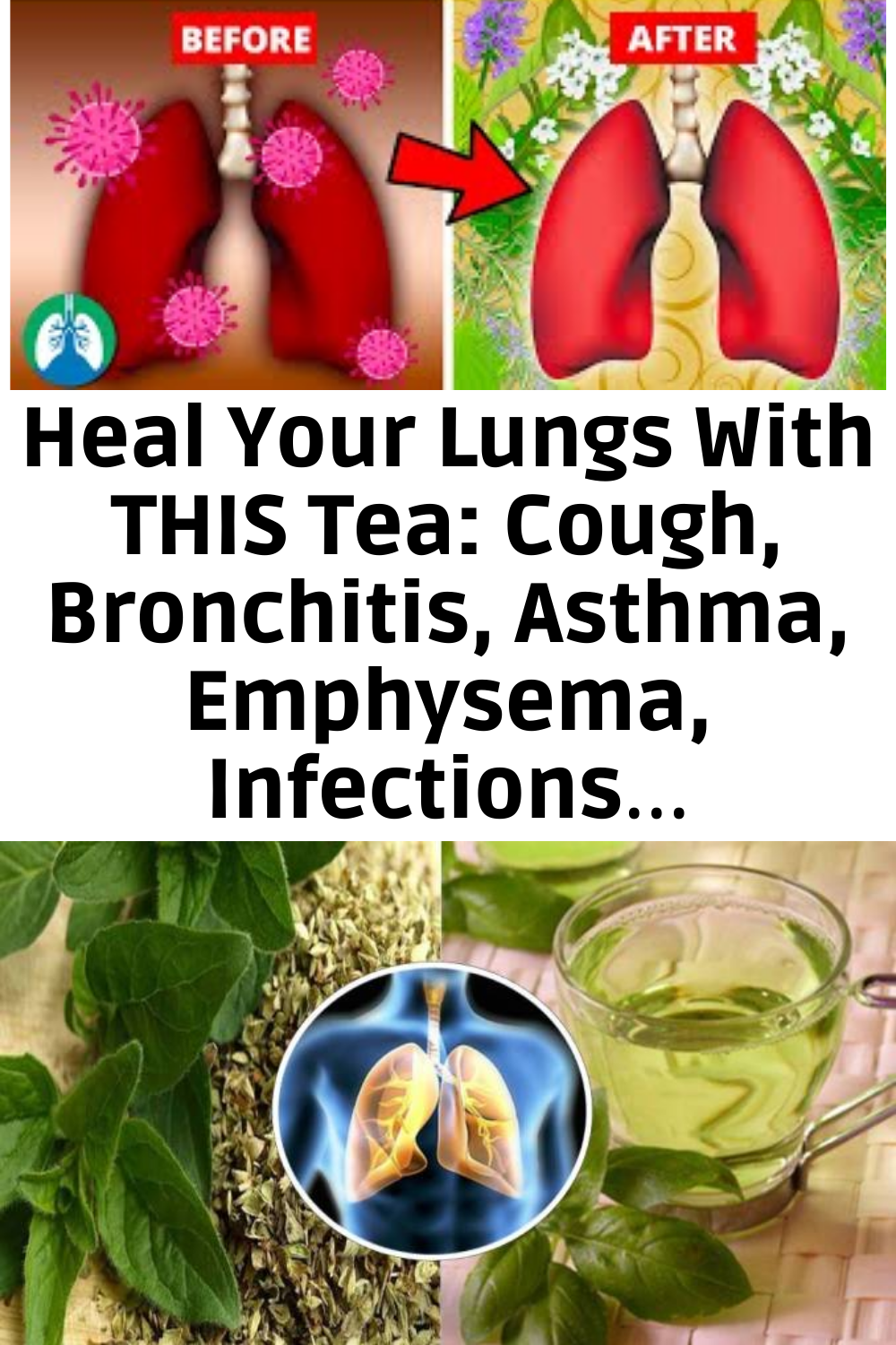 Heal Your Lungs With THIS Tea Cough, Bronchitis, Asthma, Emphysema