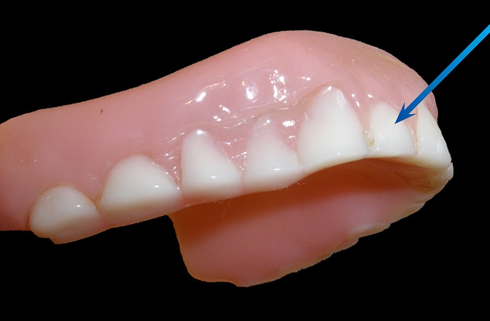 Denture Question & Answer. How long should a pair of dentures… by