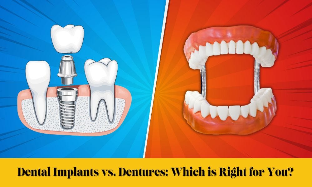 Dental Implants vs. Dentures Which is Right for You? by Modern