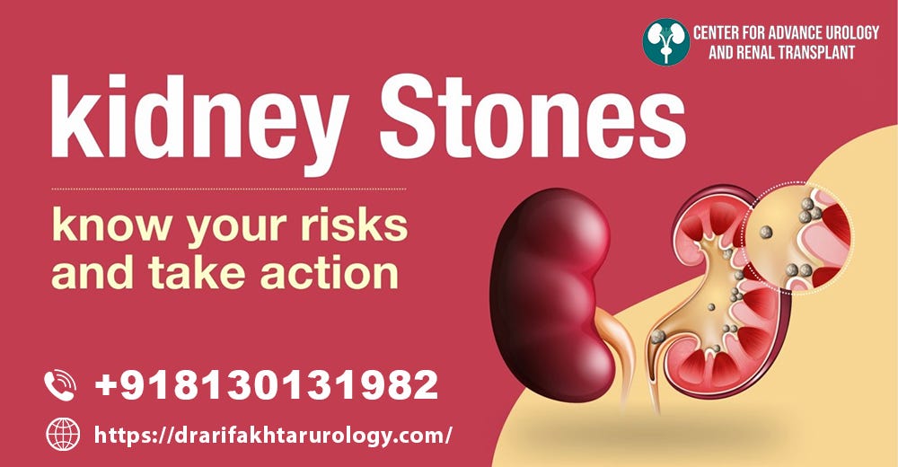 kidney stone treatment gurgaonUnveiling Kidney Stones: A Patient’s ...